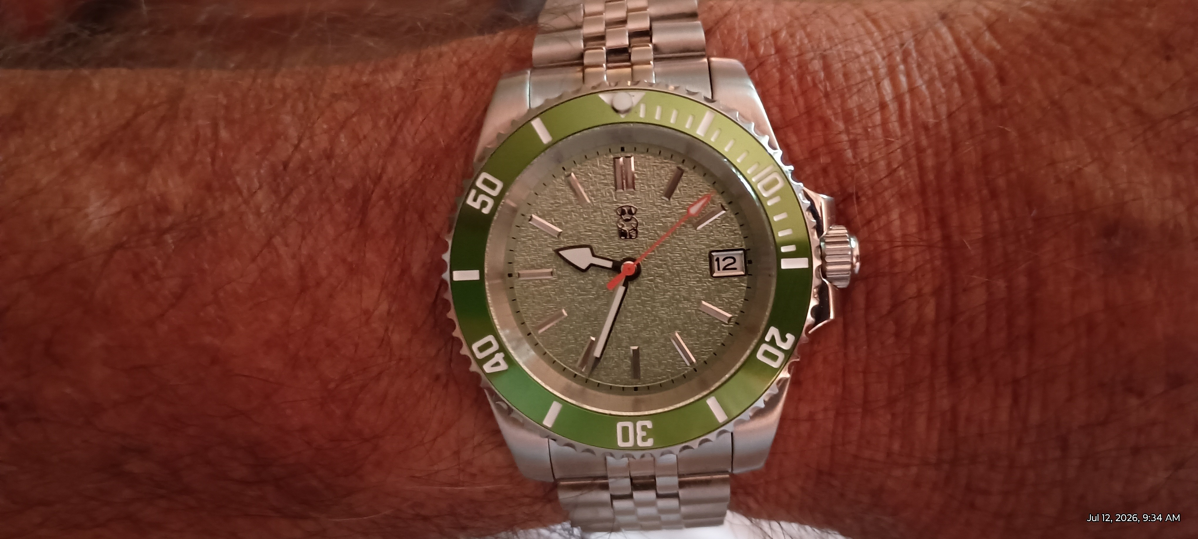 SubLime on Thomas's wrist